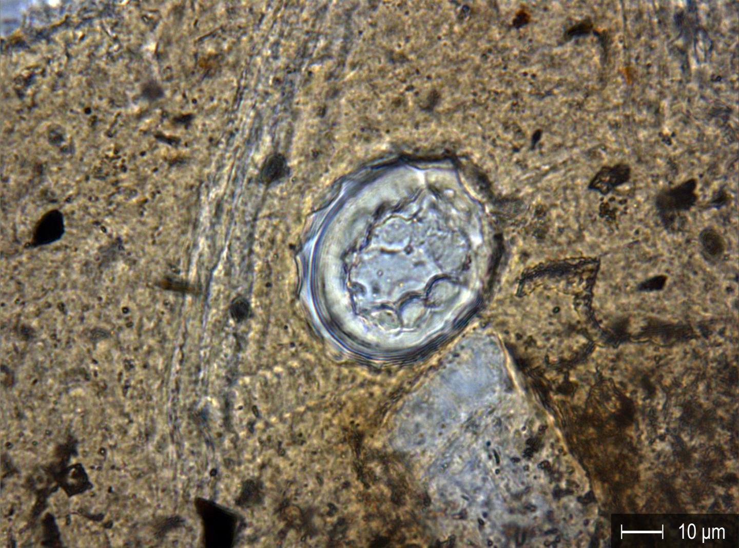 2,000 Year Old Parasite Eggs Found In Iron Age Cellar | Science 2.0